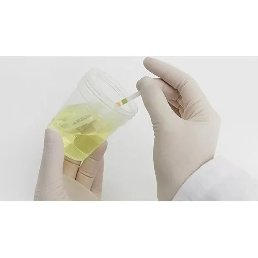 شرائط فحص البول كومبير 10 بارومتر 3